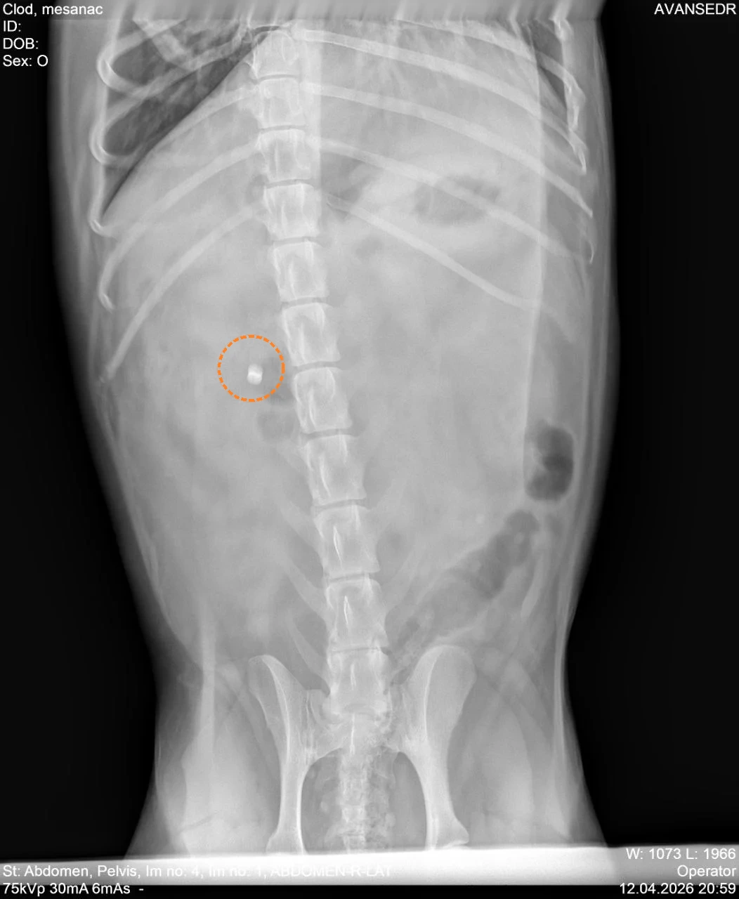 Мой рентген: позвоночник и пуля у него